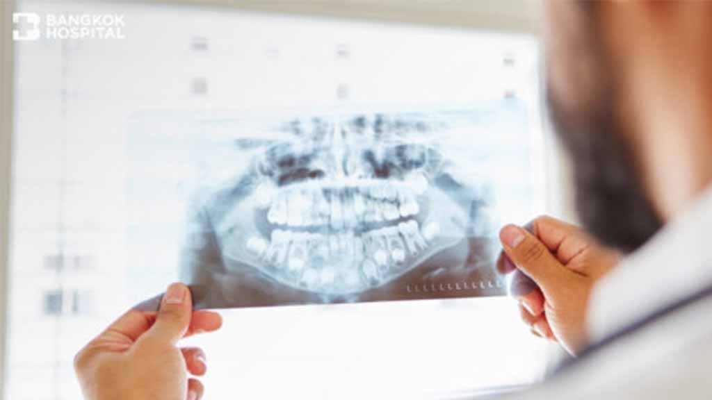 5 Things That You May Not Know About Maxillofacial Surgery