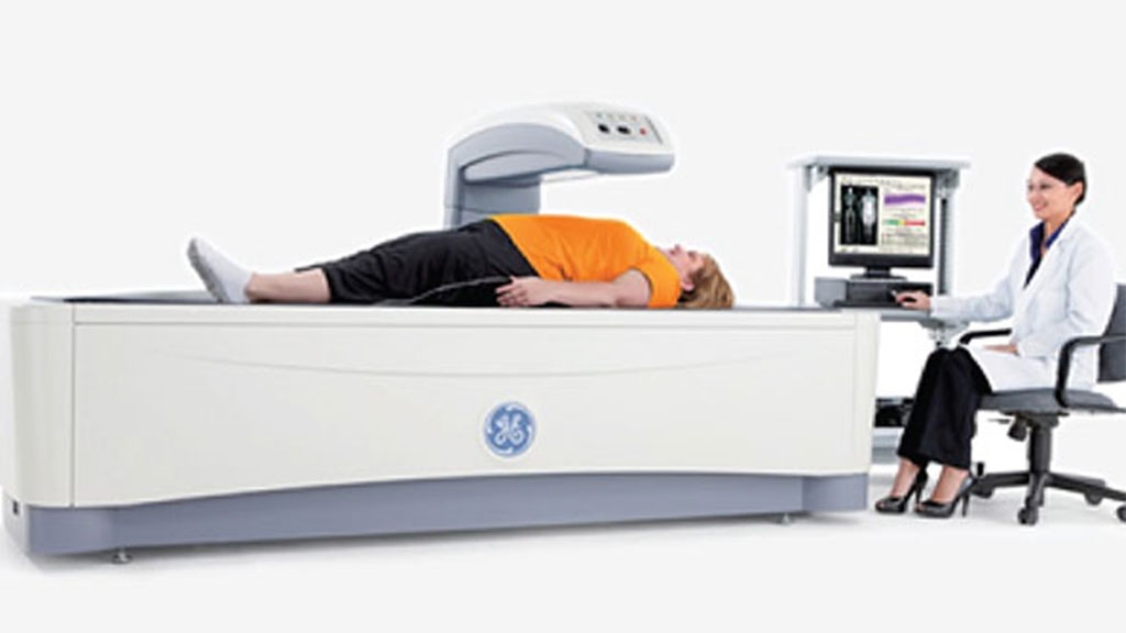 Bone Density Scan