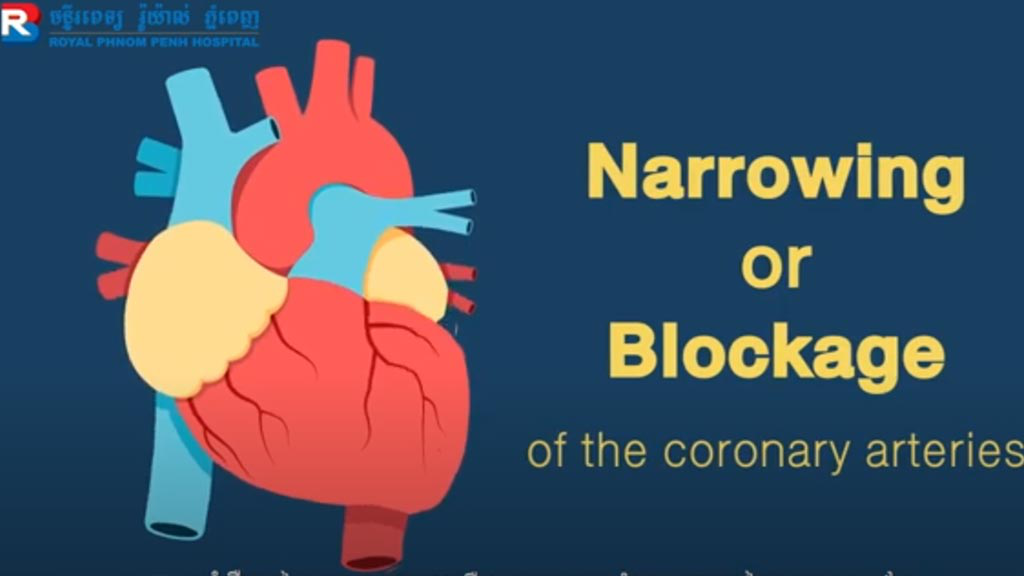 Royal Phnom Penh Hospital_Coronary Artery Disease (CAD)